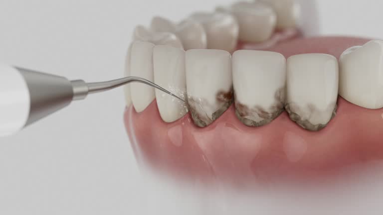 Reliable Emergency Dentist contractor in La Vale, MD by Smile Center Dentistry